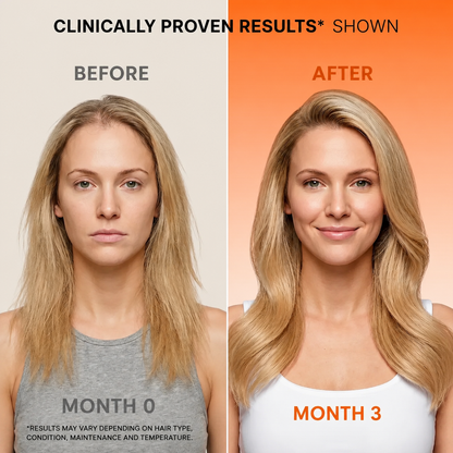 SCALÉA™ Revitalising Scalp Serum - 10,000+ Reviews | 4.8★